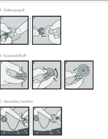 Figure 1.  Common disconnection mechanisms