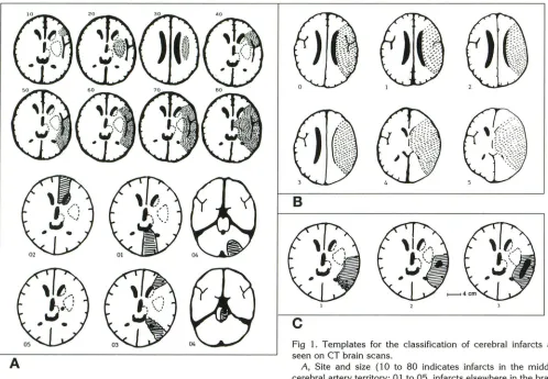 Fig 1. seen Templates for the classification of cerebral infarcts as on CT brain scans