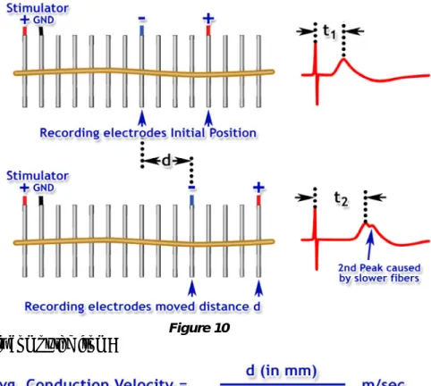 Figure 10  The conduction velocity is computed from: 