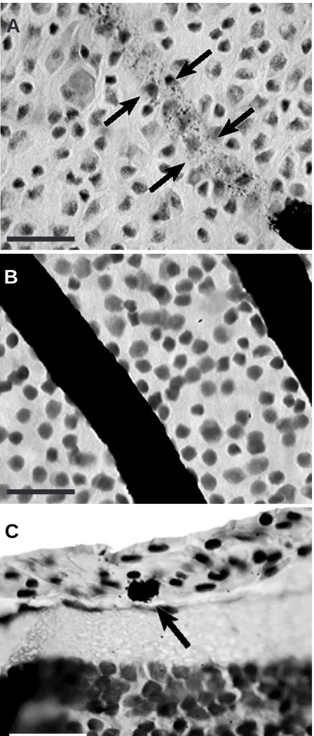 Fig. 1. (A,B) Ink-ﬁlled vessels in whole-mounts counterstained withCresyl Violet. Incomplete ﬁlling (A) showed that vessels (blackoverlying neural retina (black arrow)