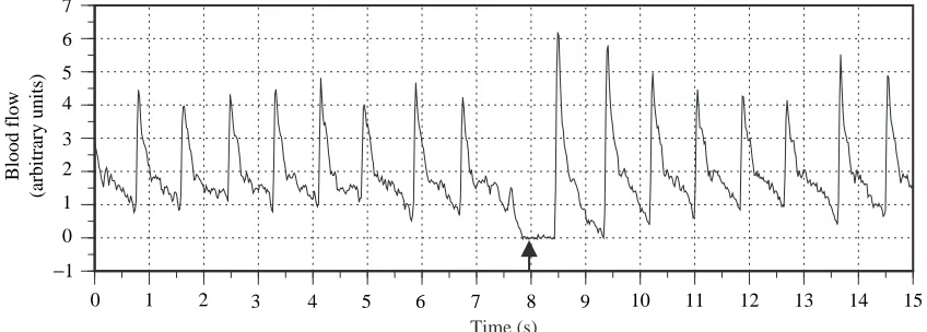 Fig. 1. Instantaneous blood ﬂow trace from a swimming yellowﬁn tuna (1.73FL s−1). The arrow indicates veriﬁcation of zero ﬂow duringspontaneous bradycardia.