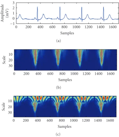 Figure 3: (a) MIT-BIH ECG record number 106, (b) time-frequency representation with WT, (c) the same representation withBWT.