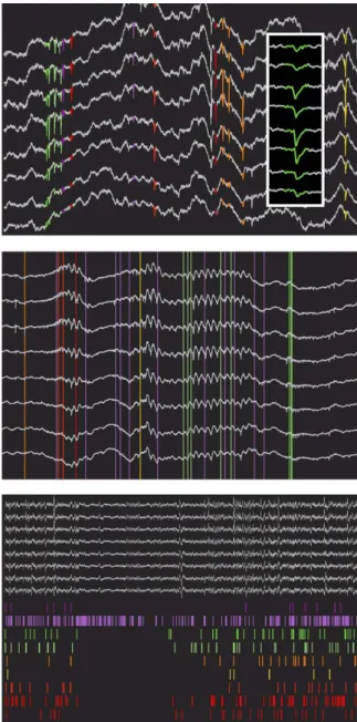 Fig. 7. Trace views: layouts. Electrode groups are displayed in different col- col-ors, either in vertical arrangements (top, tetrodes), in columnar arrangements (middle, silicon probes with regularly spaced recording sites), or in arbitrary layouts (botto