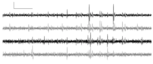 Figure 1: The first 400 ms of data on site 1, 2, 3 and 4 (from top to bottom) of one tetrode