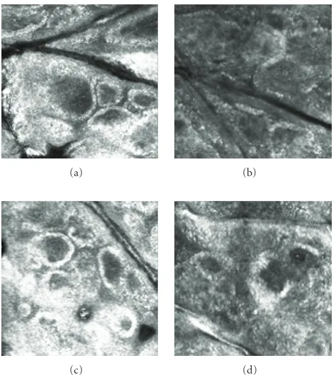 Figure 1: Laser scanning confocal microscopy (LSCM) of supranu-clear melanin caps of dermal-epidermal junction in the forearmskin in relation to UVB exposure