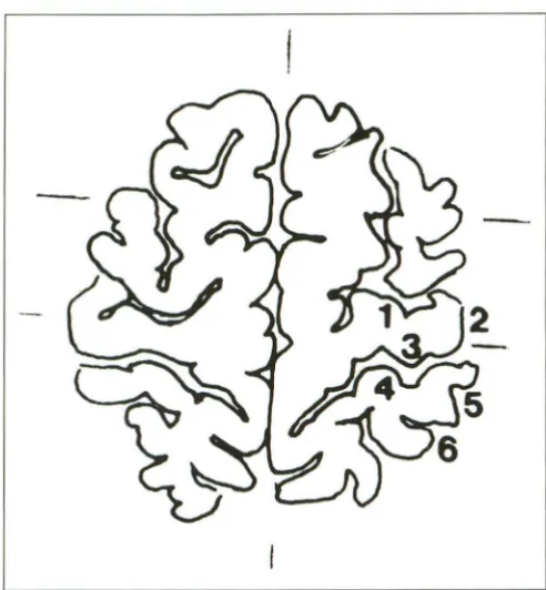 Fig. 1. (depth central sulcus); 2, the axial plane. whole series Segmentation of the profiles of sensorimotor cortex in The length of each segment was measured in the of transparent drawings
