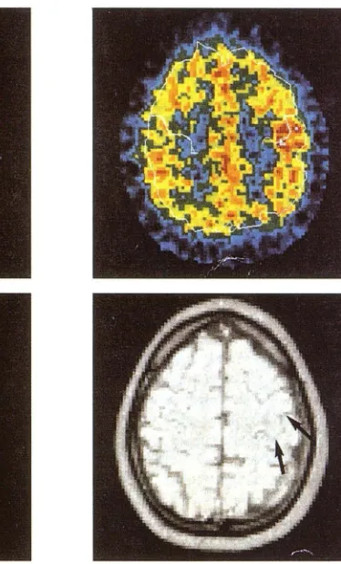 Fig. 6. Typical functional location example of anatomico-of the sensorimotor cor-