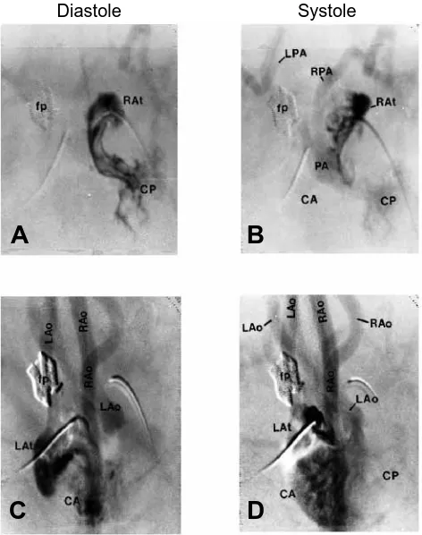 Fig. 8. The effects of changingthe vascular resistance in thepulmonary and sytemiccirculations (Rpul/Rsys) on thelevel of net cardiac shunting(Q·p�Q·s)