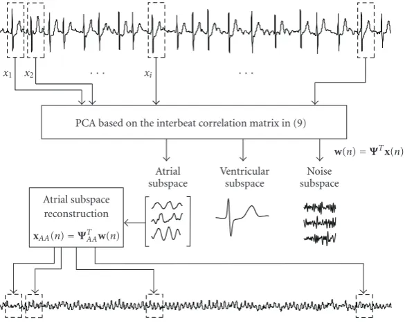 Figure��), andΨ 11: Block diagram of interbeat PCA to estimate the atrial activity during AF