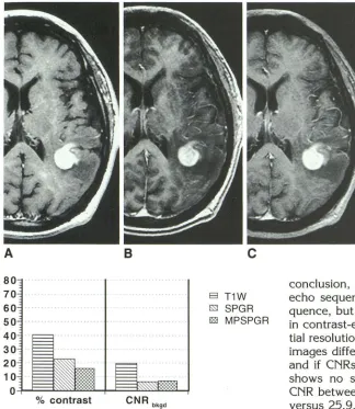 Fig. 4. Compari(247 all 20) (Atrast-enhancing lnelobe. with rvoson of spin echo (800/  ), 3-D SPGR (30/ 6) (B), and MPSPGR /3.8) (C) sequences in detecting a con-esion representing central us system lymphoma in the parietal For large contrast-enhancing les