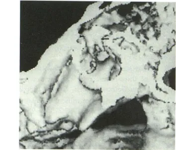Fig. 6. Three-dimensional reconstruction of (black 1-mm the ossicles from axial spiral data