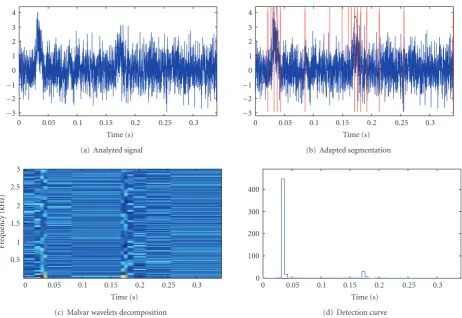 Figure 11: ROC curve for detection based on Malvar waveletadapted segmentation.