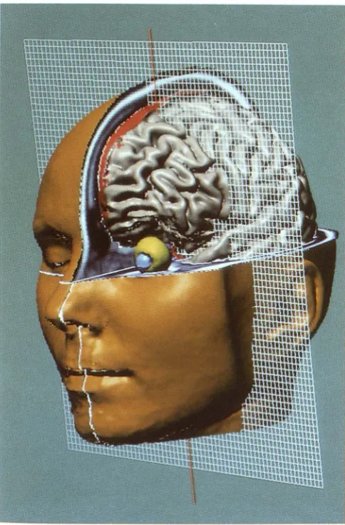 Fig. 2. Dissection of and generated this way, objects can A wire mesh the head model at the computer screen