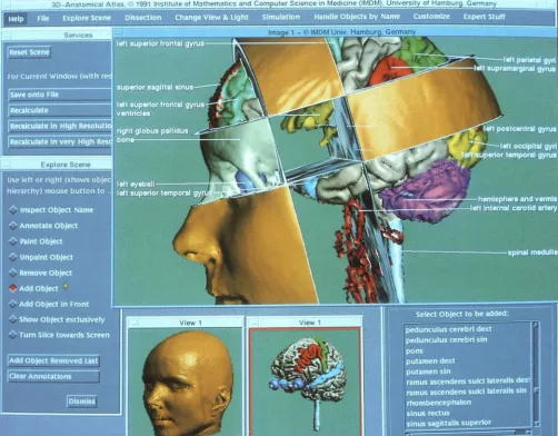Fig. the d3. "User interface" of the atlas. A viewer can address the exploration tools (left) via a mouse and generate annotated views with esired direction, size, and resolution