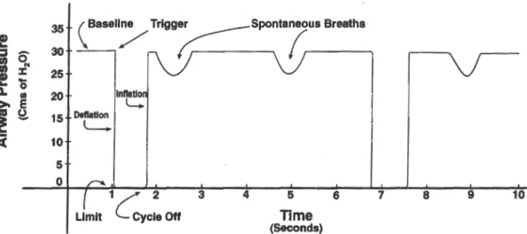 Figure 2. Airway pressure release ventilation: this can also be defined by a trigger, limit, and cycle off feature.