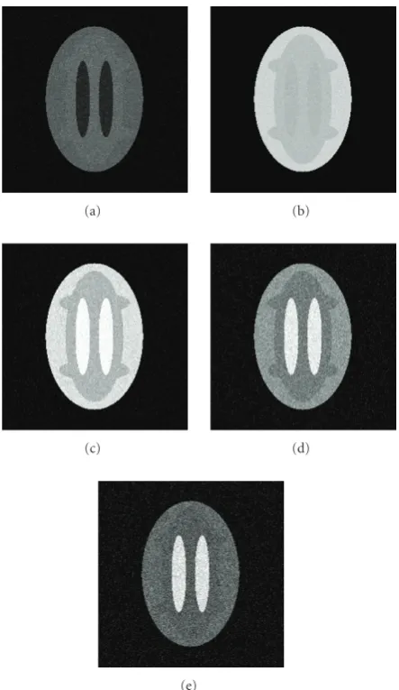 Figure 7: Simulated brain MRIs with 5 dB noise: (a) Sequence 1;(b) Sequence 2; (c) Sequence 3; (d) Sequence 4; and (e) Sequence 5.
