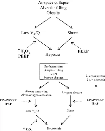 Figure 2. Hypoxemia develops as a result of alveolar hypoventilation (which is accompanied by increases in Pa CO2  and is addressed in Figure 1) and from perfusion going to areas where the ratio of alveolar  venti-lation ( A ) to perfusion ( ) is ⬍ 1.0 (i.