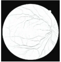 Figure 6: OD removing results: (a) original image, (b) reducing ofOD eﬀect in the original image.
