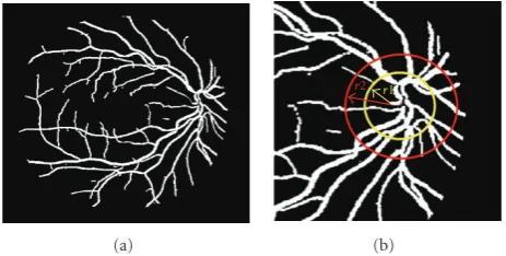 Figure 9: Blood segmentation and masking: (a) vessels pattern, (b)region of interest of vessels images around OD.