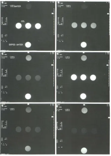Fig. 2. Images om from the phan-study. The upper row shows 