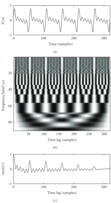 Figure 4: Autocorrelogram representation of a sum of sinusoids.�s/sample is shown in (a)