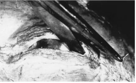 Figure 5. Sterile scissors are used to make a one centimeter horizontal incision into the tissue at the clamp site.