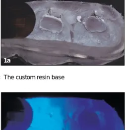 Figure 1a: The custom resin base