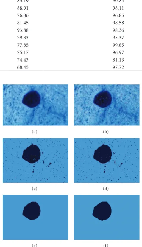 Table 1: Segmentation sensitivity from MMFD and DS, MMFAGD and DS and homogeneity method and DS for the data set shown inFigure 5.