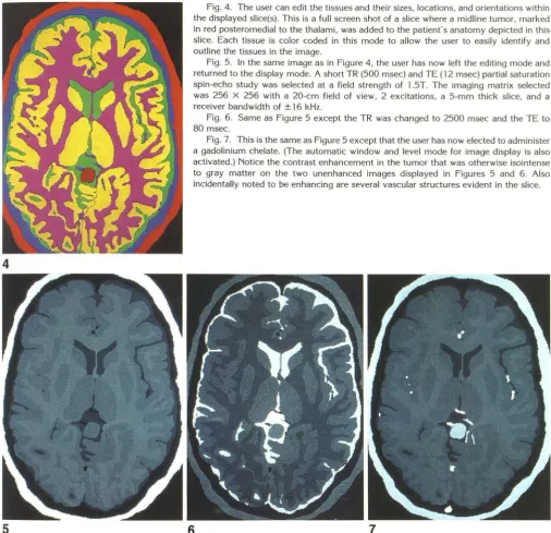 Fig. 4. The oslice. Each tissue is color coded in this in red posteromedial to the the displayed slice(s)