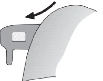 Figure 3: There is less risk of damage or bond failure due to biting forces, and therefore more opportunity for bonding in preference to banding.