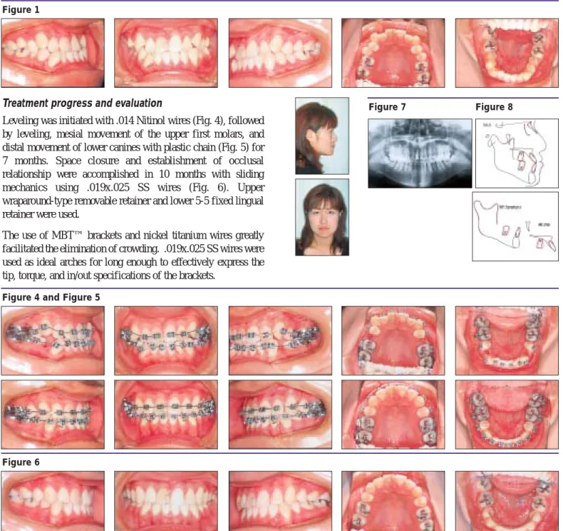 Figure 4 and Figure 5