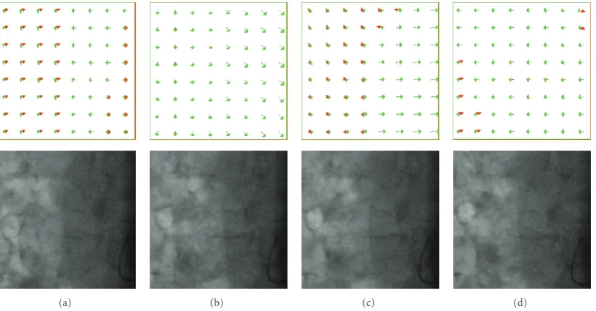 Figure 6: Four-estimated two-layer motion ﬁelds, along with the corresponding ﬂuoroscopic image at four diﬀerent time instants