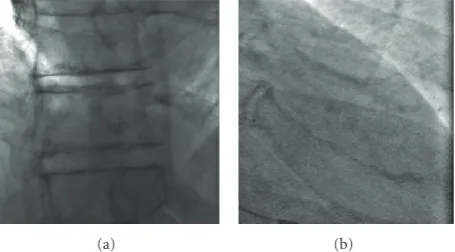 Figure 15: The two images from high-dose exams used to form thetwo moving layers in the realistic sequence generation