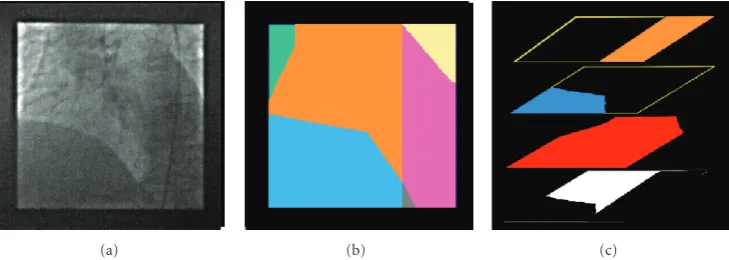 Figure 2: (a) One image of X-ray exam yielding a situation of bidistributed transparency