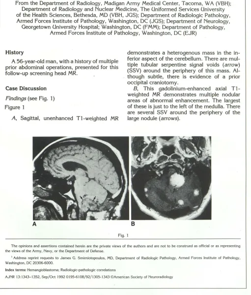Figure 1 around the periphery of MR areas large nodule of these abnormal is just to the enhancement