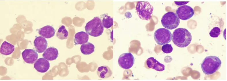 Figure 3 Very similar morphologies between cancer cells 