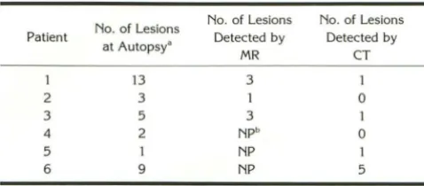 TABLE 2: Detection of cryptococcomas >3 mm in size 