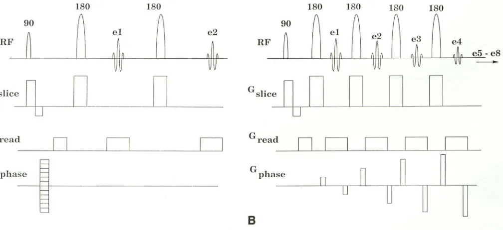 Fig. 1. A, encode gradients are athe application of slice, r8, CSE pulse sequence; the top line indicates the RF transmit pulses and the acquired echoes