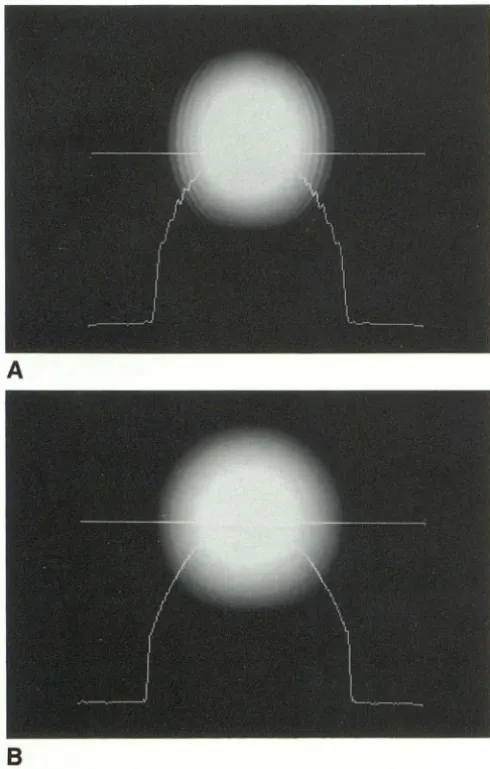 Fig. 6. Phantom imaged (A) Gibbs corresponds to signal intensities along the horizontal line of There was the center study; a homogeneous water phantom was with the FSE sequence (2000/ 90/ 2) with a 256 X 128 and a 256 X 192 matrix (B)
