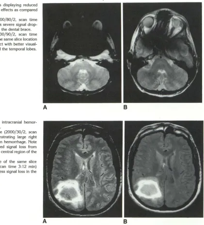 Fig. 7. witmagnetic-susceptibility effects FSE images displaying reduced as compared h CSE images