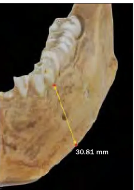 Fig 1 (Left)  Human mandible used as scan object.