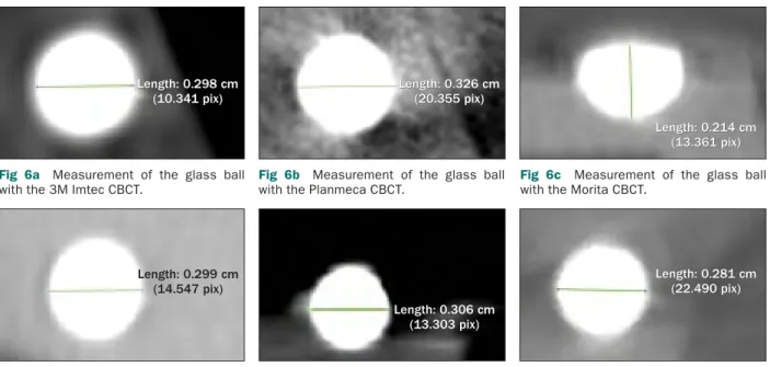 Fig 6b  Measurement of the glass ball  with the Planmeca CBCT.