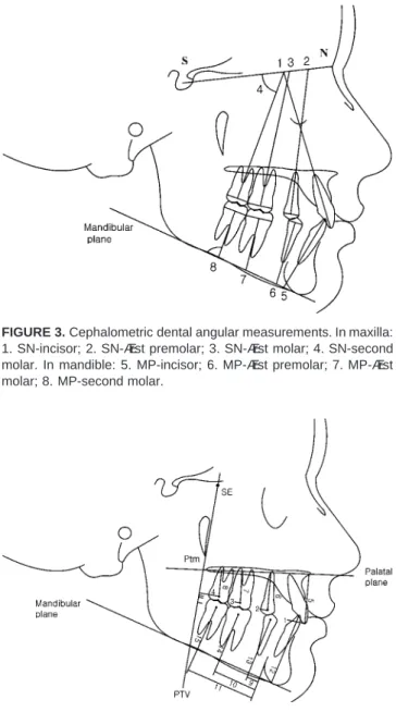 FIGURE 3. Cephalometric dental angular measurements. In maxilla: