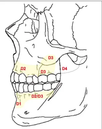 Figure 2. Regions of bone density (as classified in Misch. 14 )  D1 bone has the highest density