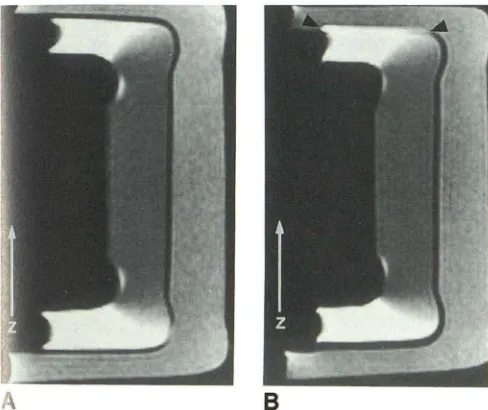 Fig. 4. Coronal fat-sauppressed images of ntom with different size of FOVs. The z 