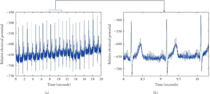Figure 4: Raw ECG data 1000 Hz (a) 20 seconds (b) 2 seconds.