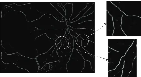 Figure 2: Example of digital retinal images showing the vessel tree. (a) Input retinal image