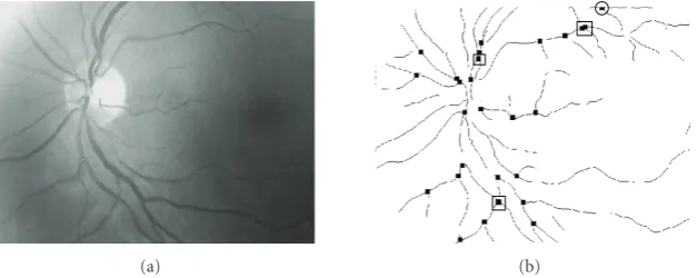 Figure 6: (a) Union of creases segmentseventually a point of segment r and s. The angles between the new segment AB and the creases segments r (α) and s (β) are nearπ rad