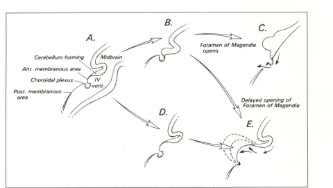 Fig. 7. ethin-walled fochoroid plexus, so the choroid comes section, cephalic membranous mbryoD Embryology; diagrammatic representation of the developing choroid plexus and roof of the fourth ventricle