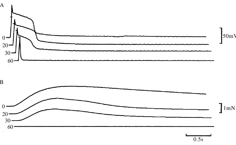 Fig. 4. Effects of addition of 25�tension (B). The short bars in A represent the 0mV level